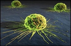 تشخیص زود هنگام تومور های سرطانی با نانو حسگرهای قابل حمل